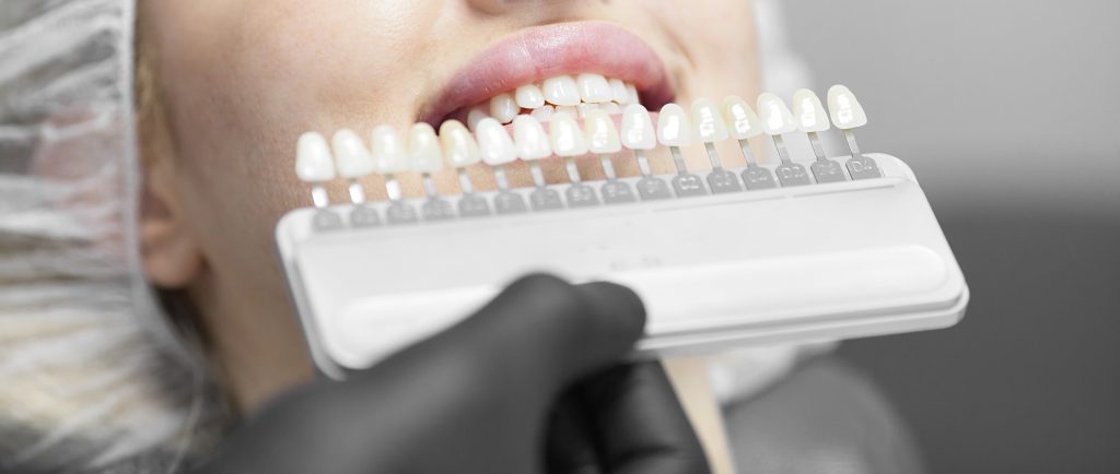 Close up portrait of Young women in dentist chair, Check and select the color of the teeth. Dentist makes the process of treatment in dental clinic office.
